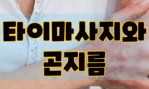 타이마사지와 곤지름